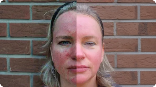 Before and after skin comparison